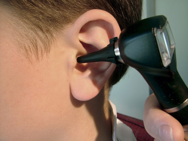 How an Audiologist Performs Ear Cleaning